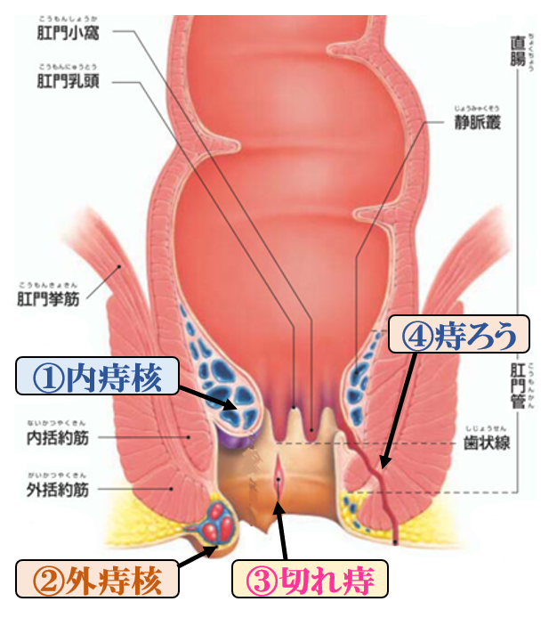 痔 は 何 科