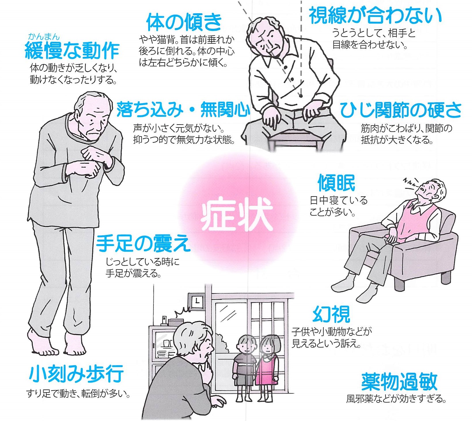 認知 症 体 が 右 に 傾く