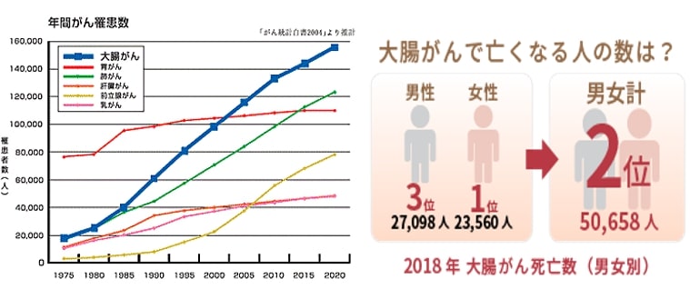 大腸がんとは