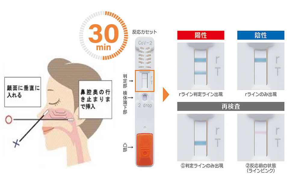 新型コロナウイルスの検査