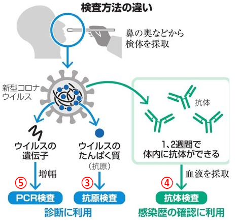 検査方法の違い