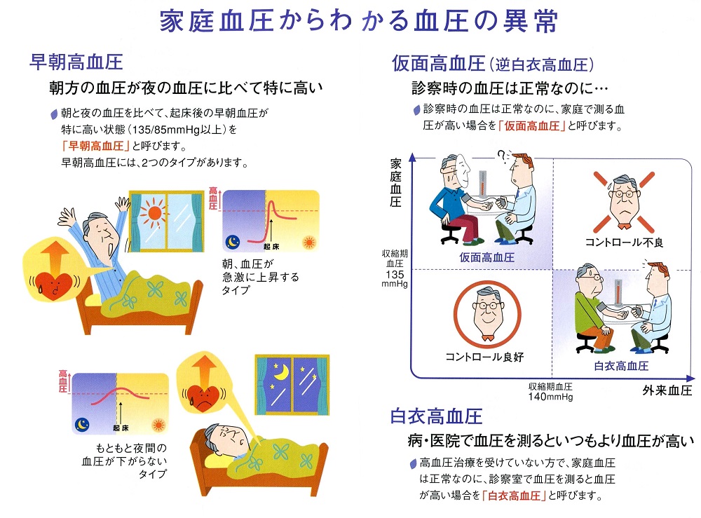 血液 検査 で わかる 高血圧 の 原因