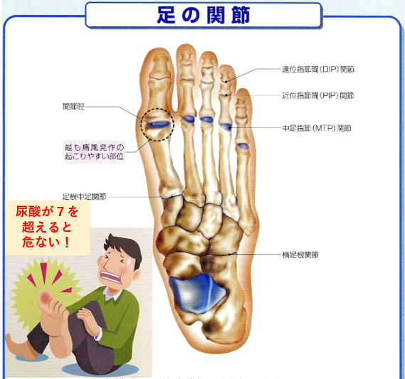 高尿酸血症・痛風とは