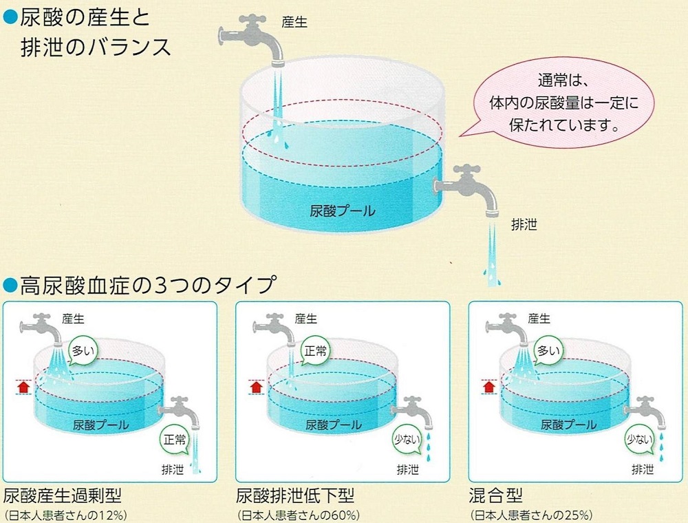 高尿酸血症になるしくみ