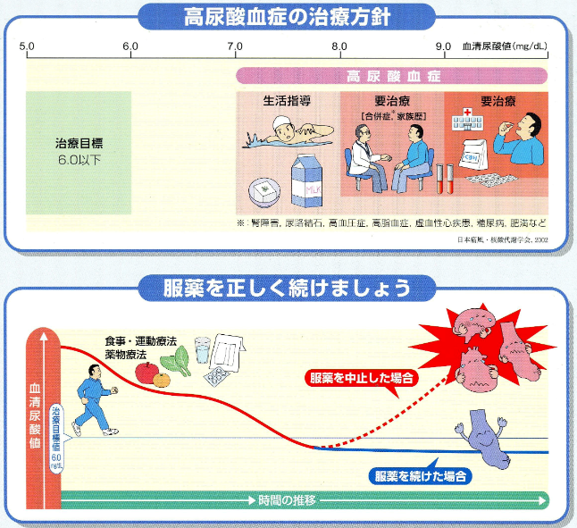 高尿酸血症の治療