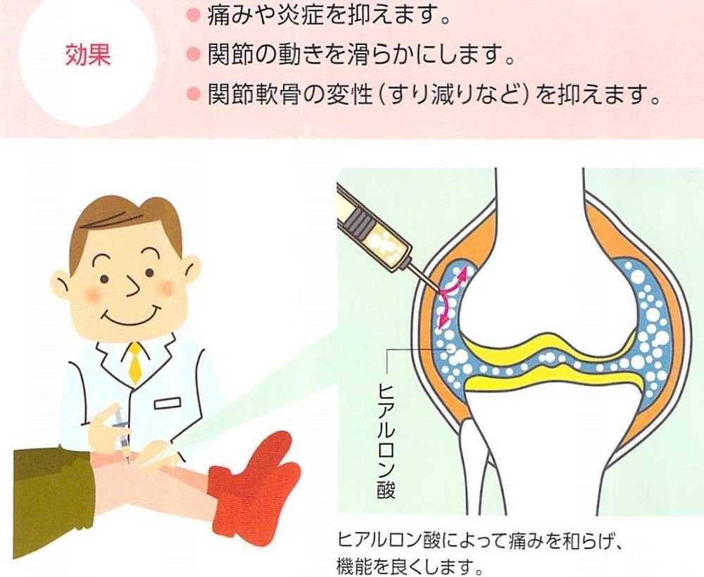 薬物療法