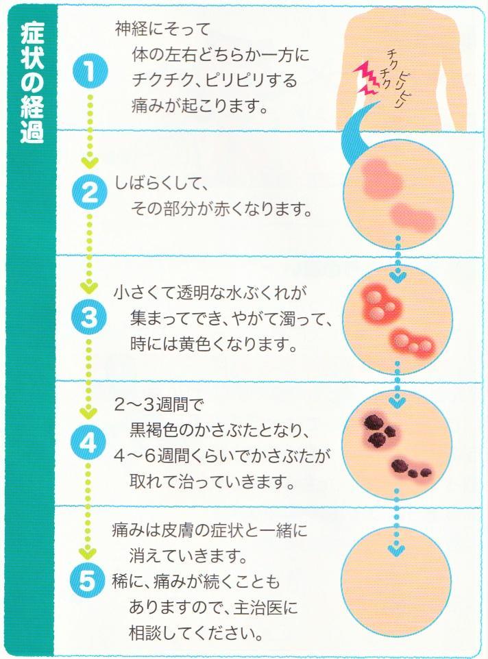 陰部 ヘルペス 早く 治す 方法