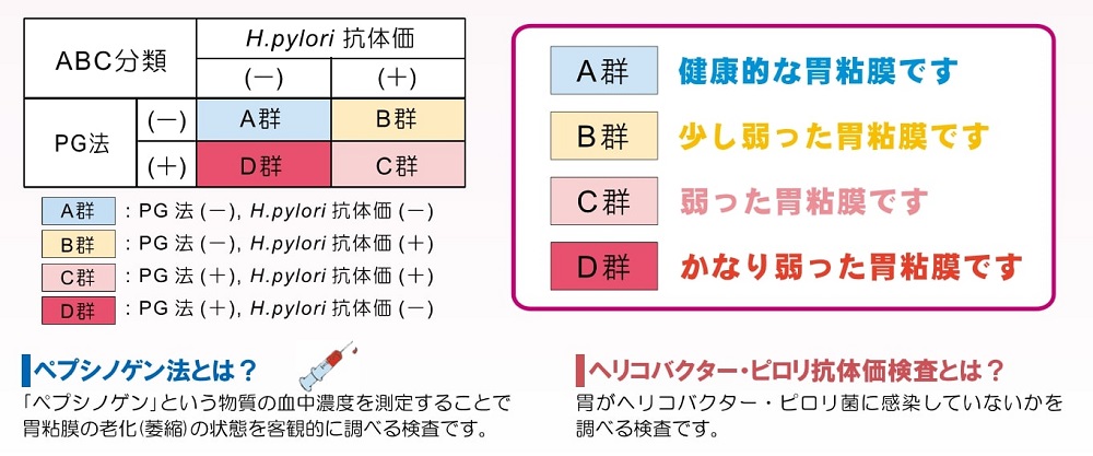 ヘリコバクター・ピロリ抗体価検査とは？