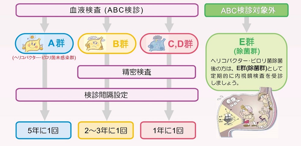 ABC分類のフローチャート